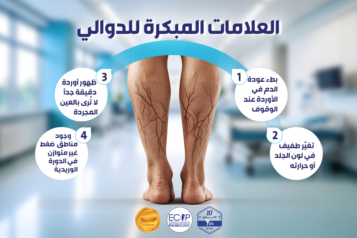 العلامات المبكرة للدوالي