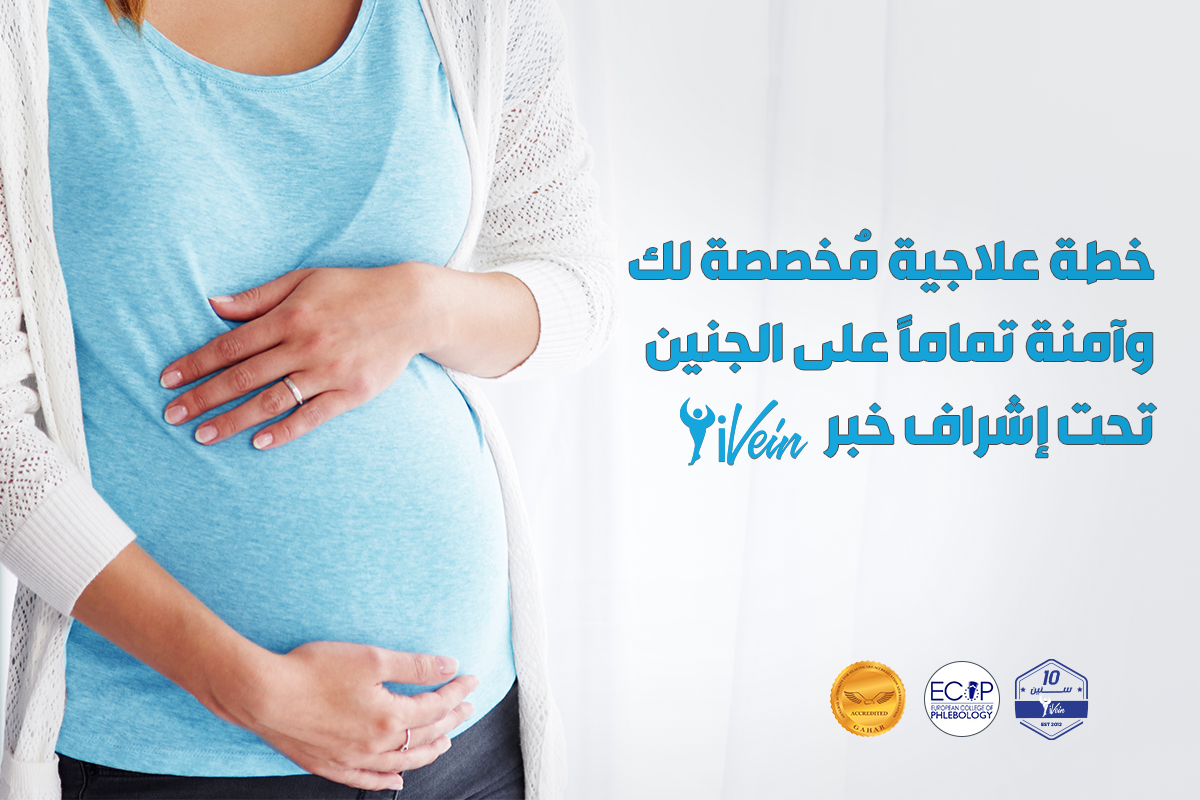 علاج الدوالى العنكبويتة للمراه